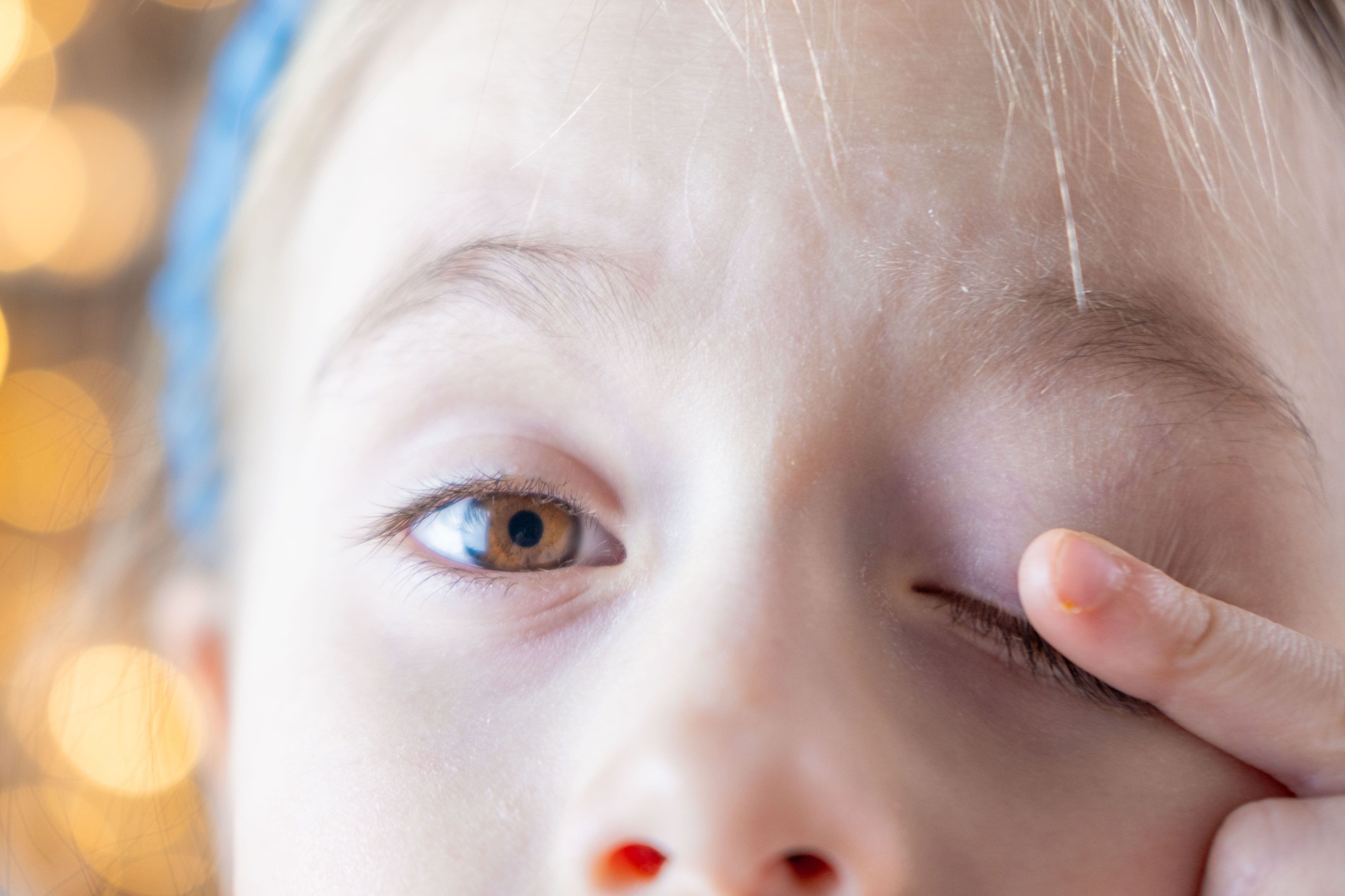 Kindergesicht. Kind hält sich mit dem linken Zeigefinger das Auge zu.