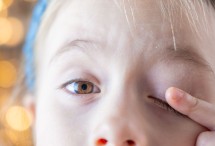 Kindergesicht. Kind h&auml;lt sich mit dem linken Zeigefinger das Auge zu.